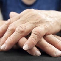 Psoriatic Arthritis CME Credits