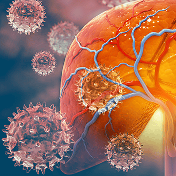 Mitigating Progression of Liver Fibrosis in HIV/HCV Coinfection